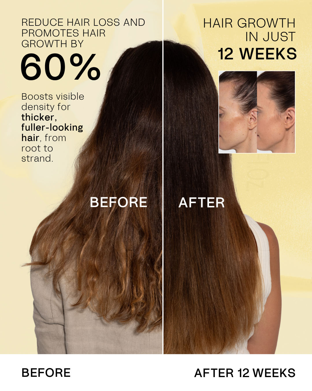TYPEBEA Daily Hair Growth & Refresh Kit: before and after hair growth results